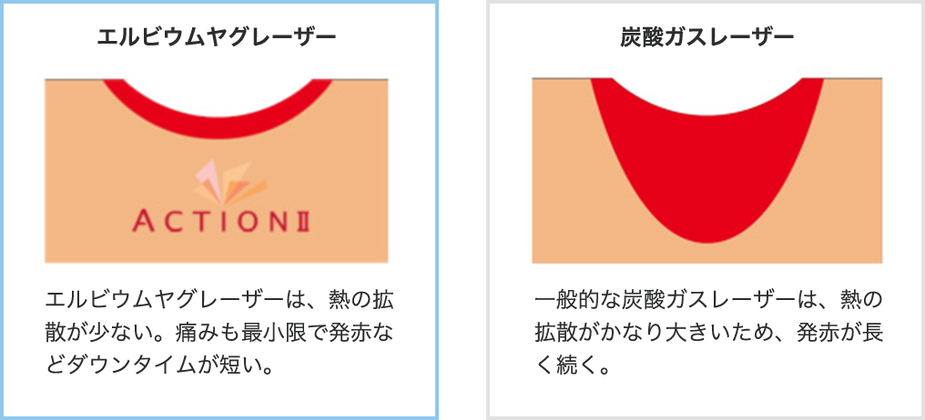 凝固層がほとんどできない