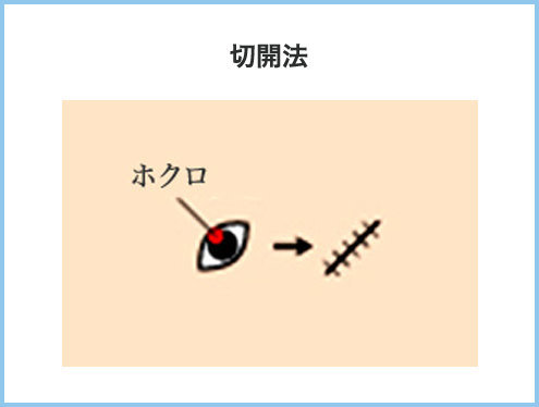 切開法